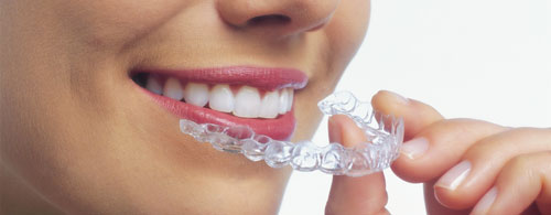 Invisalign Treatment Invisalign Treatment